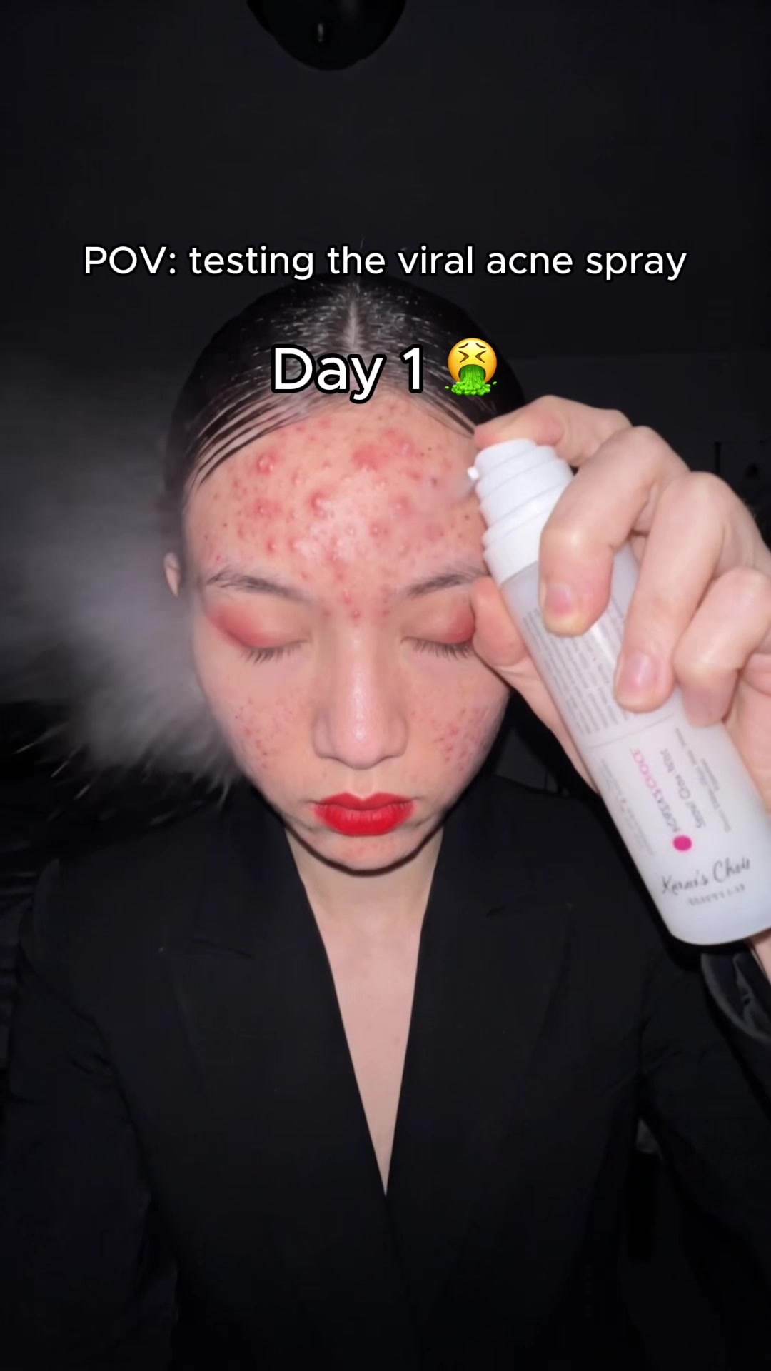 skincare short-form example by koreaschoice.acne